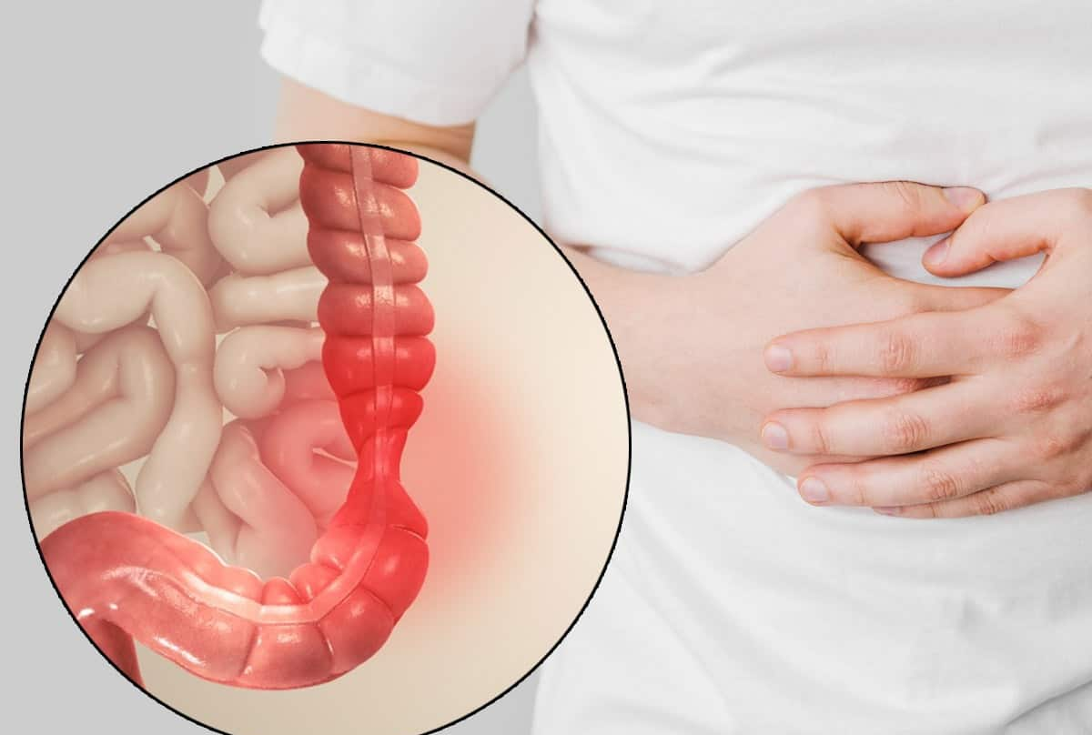 Struggling From Irritable Bowel Syndrome? Low-FODMAP Weight loss plan To Assist You Preserve It In Verify