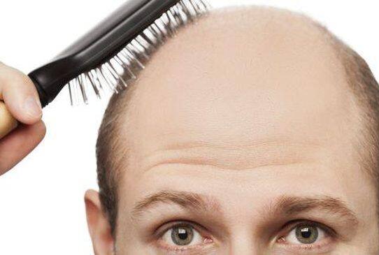 What’s ‘No Root Contact’ surgical hair transplant and restoration?