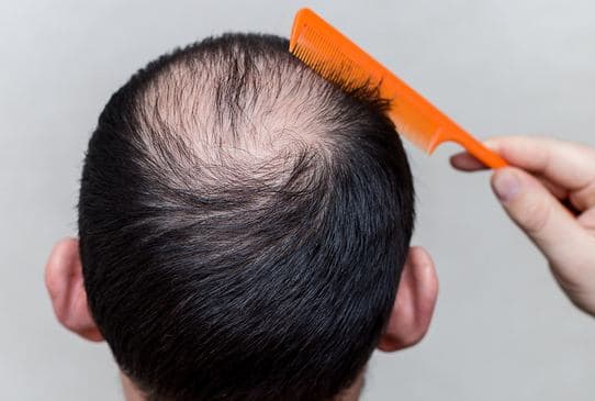 Rubbing sandalwood oil on scalp could stimulate hair progress in simply 6 days, claims examine