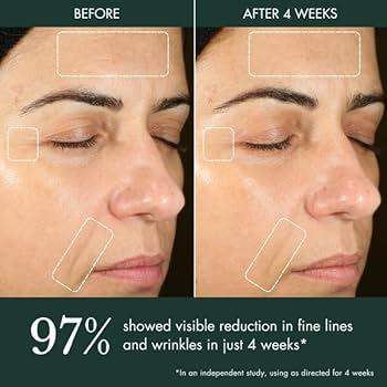 RéVive Hydrogel Moisturiser: Best Moisturizer for Post-Shave Care